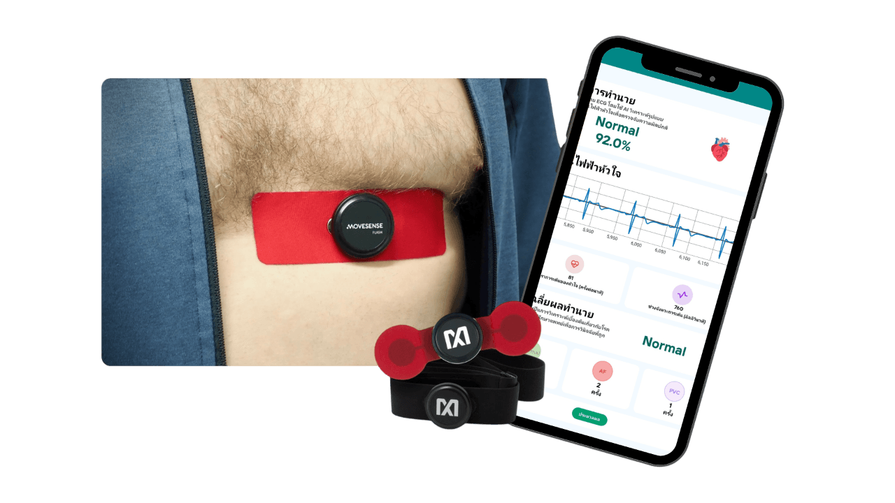 Detect Irregular Heartbeats